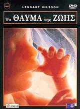      [DVD-ROM]